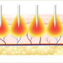 이너랩메드 이미지