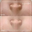 산호동274 | 마산에스테틱 앤와이뷰티 물광관리로 광채가득해진 피부