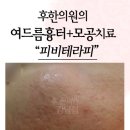 피비한의원 네이버블로그