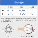 장비루 | 강남 밝은성모 안과 라섹검사 후기
