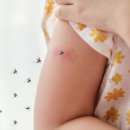 🦟 약국 모기약 추천! 써버쿨액 vs 제올라 에스액 성분 차이와 사용 후기 비교