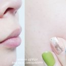 에이치바이옴 이미지