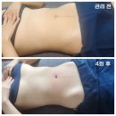 의정부 산후마사지 자랑하고 싶은 위더스산후케어 의정부양주점 추천후기