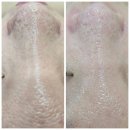 마음에 점을 찍다 안양점 | 인덕원피부관리 마음에점을찍다 안양점 마이크로젯 솔직후기