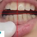 논현수치과의원 이미지