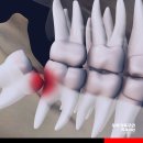 우리가족주연치과의원 네이버블로그