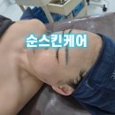 순피부관리전문점 | 창원 성산구 피부관리 순스킨케어 건조한 피부 탄력관리받고 온 솔직 후기