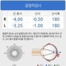 스마일택시 | 강남 스마일라식 스마트 노바 프로 수술 후기
