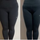 허벅지 지흡 후기 5주차 음주 바본 뭉침 주차별변화사진