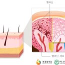 천안수피부과 이미지