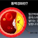 경화설비