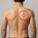 마름모한의원 | 능형근 근막 통증 개선 실제 후기