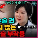 백내장 무조건 빨리하면 후회합니다 최적의 수술 시기 &amp; 관리법 총정리 이미지