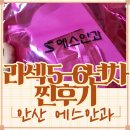 안산에스안과 라섹 후기 5년차현재시력 복시 가격할인 +S안과 망막박리망막열공레이저