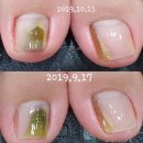 야시손톱 - 김천시 혁신4로 63 | 야시손톱