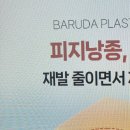바르다성형외과의원 네이버블로그