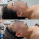 청춘강서점 | 강서 윤곽관리 청춘미남 후기｜얼굴선 정리 체감한 관리 경험