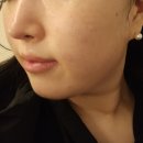창원피부관리 잘하는 곳 예담에스테틱 상남점 윤곽관리 솔직후기