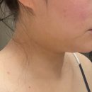 90 | 리셋90 내돈내산 부작용 후기에요