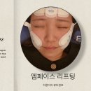 제2회 광주화루 <10인의 작가展> | 광주 엠페이스 리프팅 2회차 후기｜나이 들수록 신경 쓰이는 불독살과 팔자주름