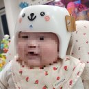 수정-99 | 하니헬멧 판교센터 단두교정 솔직 후기 2 (단두증/사두증/헬멧수정)