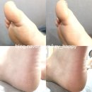 [대구 다사 뷰티샵] 대구 다사 발각질관리 전문 '메이드83' 패디플래닝 후기