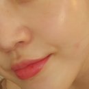 오송마을2안길 | 청주 오송 피부관리 문라이트