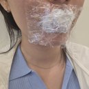 [압구정피부과] 얼룩덜룩 망한 입술 복구문신 2회차 리터치, 여름뮤트 인생 립타투 완성 후기!