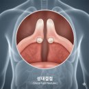 맑은솔이비인후과의원 | 부산성대결절 목이 쉬는 이유, 단순 피로가 아닐 수 있습니다