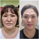 과연 (주)비아블 셀비아 제품 효과가 좋을까요? 사용 후기 및 임상 사진 공개합니다.