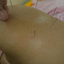 강남제일한의원 이미지