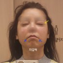 새천지약국 | 부산 레디어스 + 티파니 리프팅 2회차 하고 왔어요