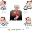 위식도 역류질환 발생 원인부터 해결까지 이미지