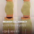 압구정 스컬트힙 3회차 즉각적인 힙업 효과 솔직후기 3탄