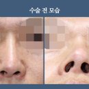 비주 이미지