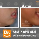 스마일닥터스