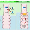 유당불내증 우유 알레르기 설사 이미지