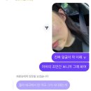 유연약국 | 태국 약국 기념품 ACNETIN-A 0.025% 연고 사용법, 부작용 및 효능