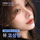 실비미용재료 | 코성형후기 속 숨은 진실? 그리고 나에게 알맞은 선택 기준! <필독>