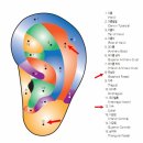 이혈요법 이미지