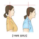 아산건강안마원 | 거북목 일자목 만성 어깨통증에 효과본 해결법 4가지