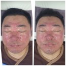 비아블의 셀비아 양수줄기세포 배양액앰플과 뷰티케어 제품들 후기 첫번째일기