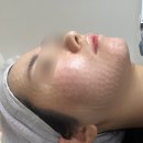 분당메디칼약국 | 수지구청역피부과 통증 적은 리쥬란 스킨부스터 솔직후기!