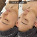 비타 | 마곡 신부관리 움트다에스테틱 오쏘민C 비타플란트 후기