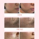 에스텔라 이미지