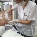 레푸스네일 이미지
