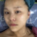 벨레자아로마 | 천안 신불당 피부관리 스토리에스테틱 이용 후기 | 작은얼굴 리프팅 후기