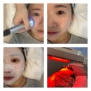 원탑바이오 | 김해 예신피부웨딩관리 딥리바이탈 수분재생관리 장유피부관리 데이로제뷰티