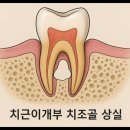 송탄더봄치과의원 네이버블로그