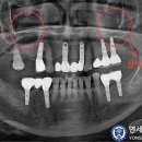 연세강치과의원 이미지